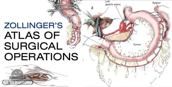 دانلود Zollinger's Atlas of Surgery v1.2 - برنامه بینظیر اطلس جراحی برای اندروید