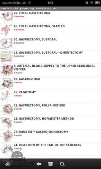 دانلود Zollinger's Atlas of Surgery v1.2 - برنامه بینظیر اطلس جراحی برای اندروید