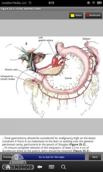 دانلود Zollinger's Atlas of Surgery v1.2 - برنامه بینظیر اطلس جراحی برای اندروید