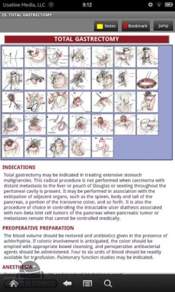 دانلود Zollinger's Atlas of Surgery v1.2 - برنامه بینظیر اطلس جراحی برای اندروید