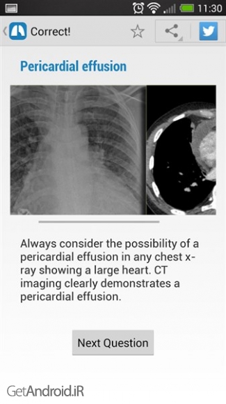 دانلود Chest X-Ray Training v1.01 برنامه آموزش رادیوگرافی قفسه سینه اندروید