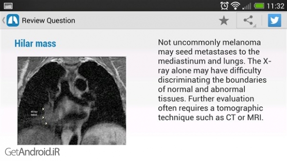دانلود Chest X-Ray Training v1.01 برنامه آموزش رادیوگرافی قفسه سینه اندروید