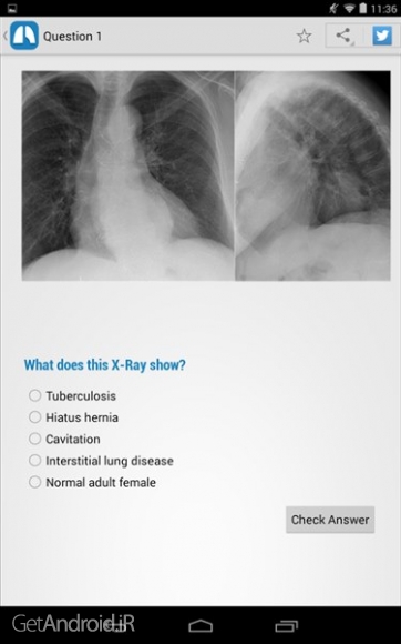دانلود Chest X-Ray Training v1.01 برنامه آموزش رادیوگرافی قفسه سینه اندروید