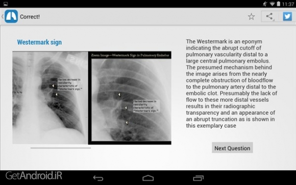 دانلود Chest X-Ray Training v1.01 برنامه آموزش رادیوگرافی قفسه سینه اندروید