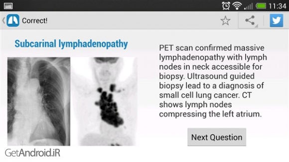 دانلود Chest X-Ray Training v1.01 برنامه آموزش رادیوگرافی قفسه سینه اندروید