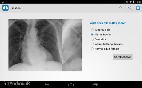 دانلود Chest X-Ray Training v1.01 برنامه آموزش رادیوگرافی قفسه سینه اندروید